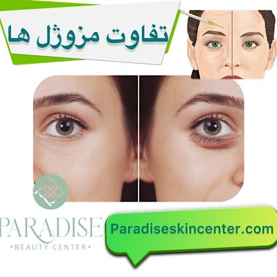 تفاوت مزوژل‌ها 