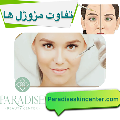 تفاوت مزوژل‌ها 