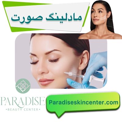 مادلینگ صورت