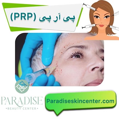 پیآرپی