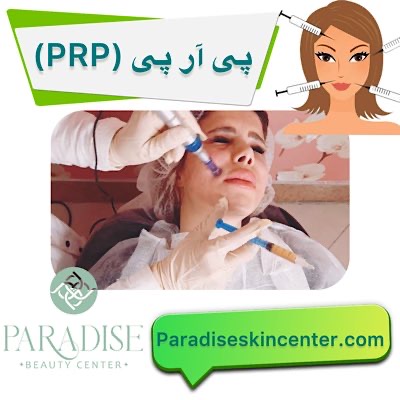 پیآرپی