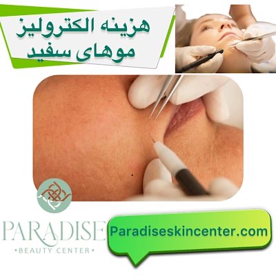هزینه الکترولیز موهای سفید