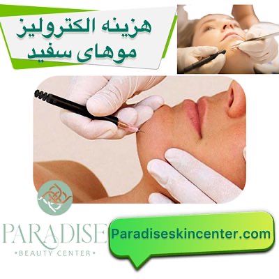 هزینه الکترولیز موهای سفید