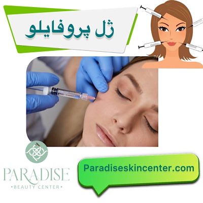 پروفایلو