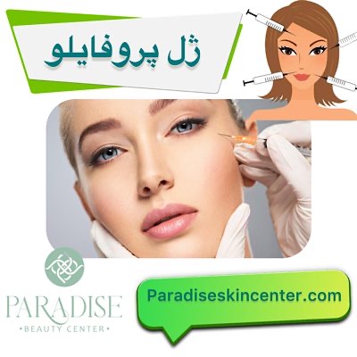 پروفایلو