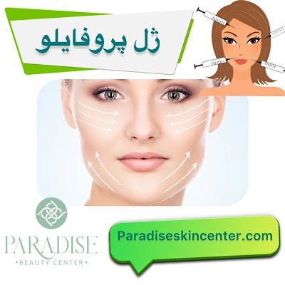 پروفایلو