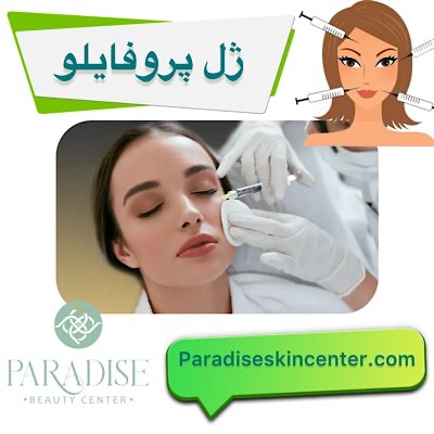 پروفایلو