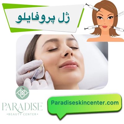 پروفایلو