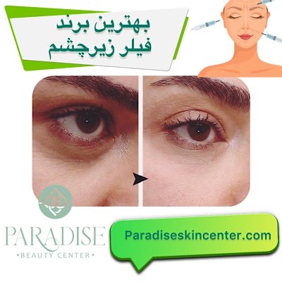بهترین برند فیلر زیر چشم