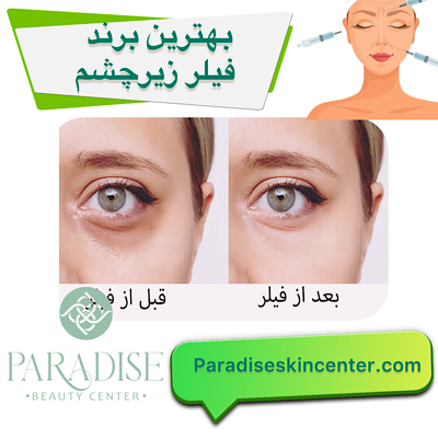 بهترین برند فیلر زیر چشم