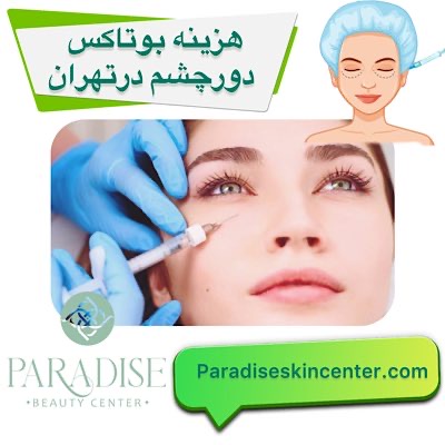 هزینه بوتاکس دور چشم 