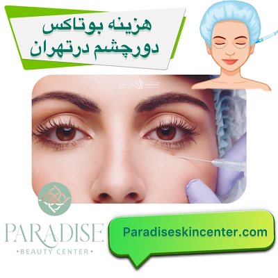 هزینه بوتاکس دور چشم 