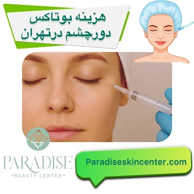 هزینه بوتاکس دور چشم 