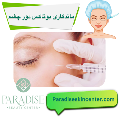 ماندگاری بوتاکس دور چشم