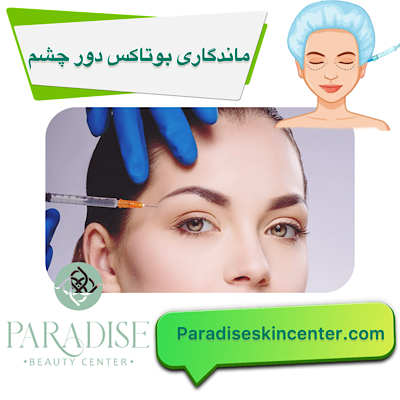 ماندگاری بوتاکس دور چشم