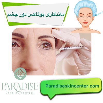 ماندگاری بوتاکس دور چشم