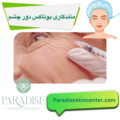 ماندگاری بوتاکس دور چشم