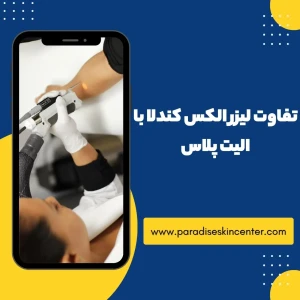تفاوت لیزر الکس کندلا با الیت پلاس