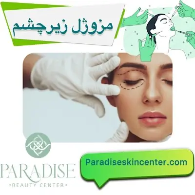 مزوژل زیرچشم