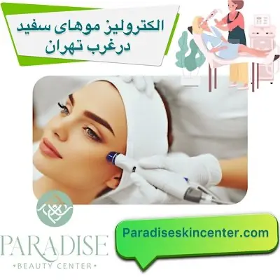 الکترولیز موهای سفید در غرب تهران
