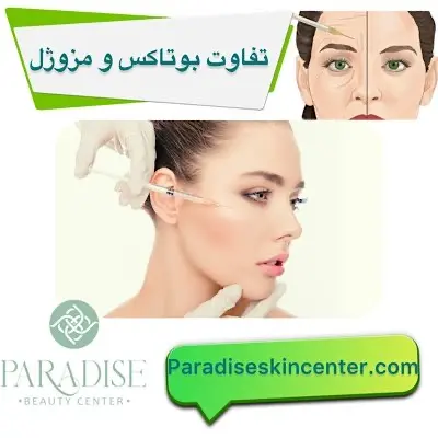 تفاوت مزوژل و بوتاکس