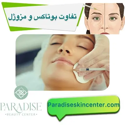 تفاوت مزوژل و بوتاکس