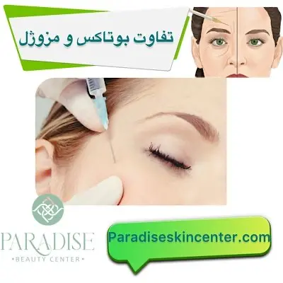 تفاوت مزوژل و بوتاکس