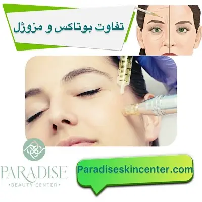 تفاوت مزوژل و بوتاکس
