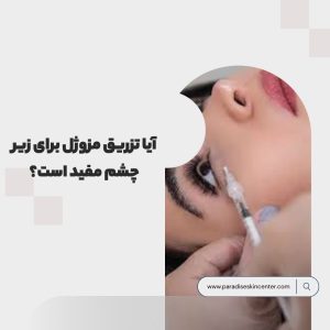 آیا تزریق مزوژل برای زیر چشم مفید است؟