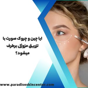 ایا چین و چروک صورت با تزریق مزوژل برطرف میشود؟