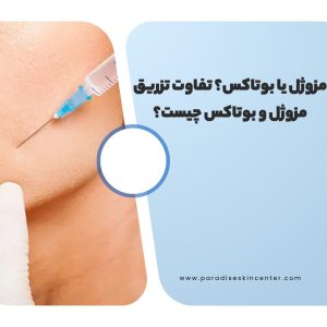 مزوژل یا بوتاکس؟ تفاوت تزریق مزوژل و بوتاکس چیست؟