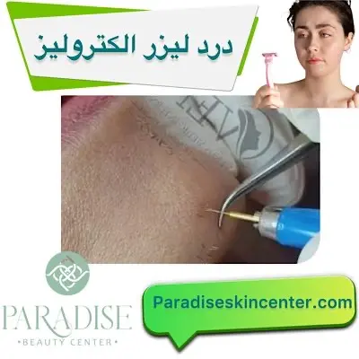 درد لیزر الکترولیز