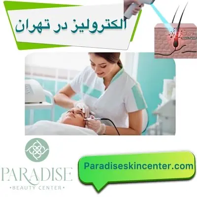 الکترولیز در تهران