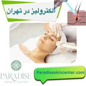 الکترولیز در تهران