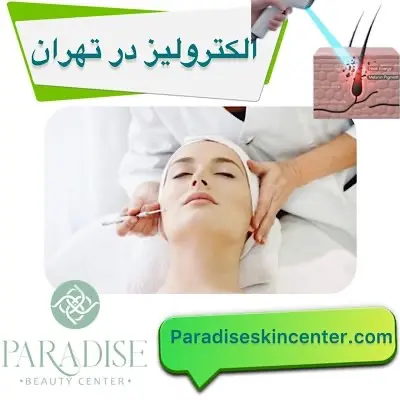 الکترولیز در تهران
