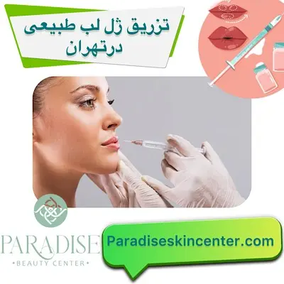 تزریق ژل لب طبیعی در تهران