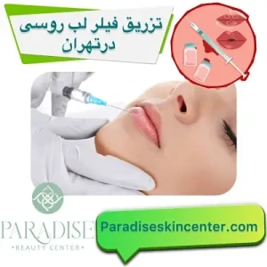 تزریق فیلر لب روسی در تهران