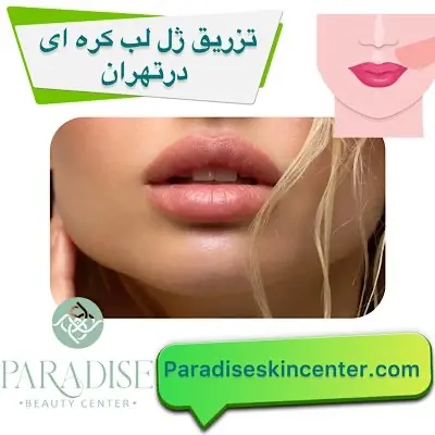 تزریق ژل لب کره ای در تهران