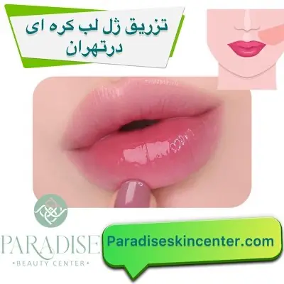 تزریق ژل لب کره ای در تهران
